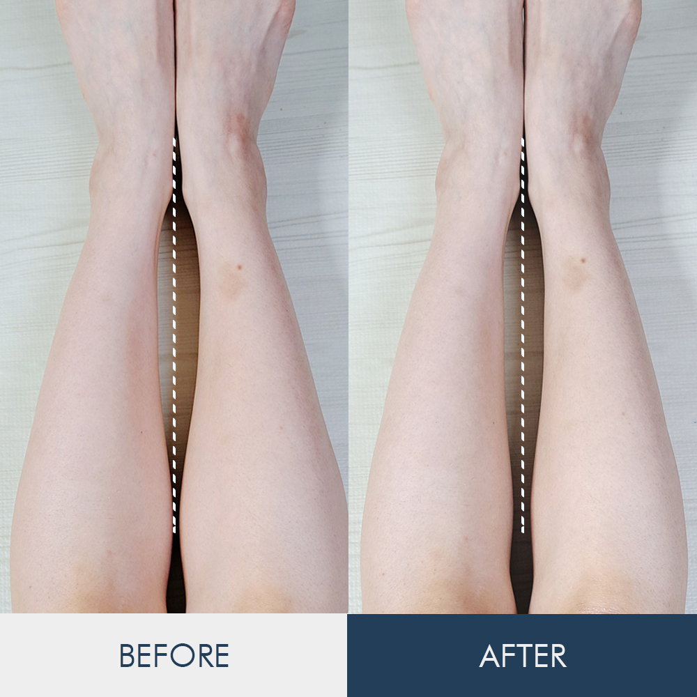 벨라쉐이프 악티브 크림 150ml ( 쿨링+발열감)