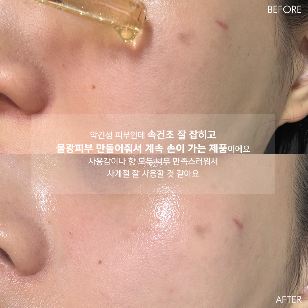 리더미스 리싱크세럼 55ml + 아클레온 토닝로션 200ml