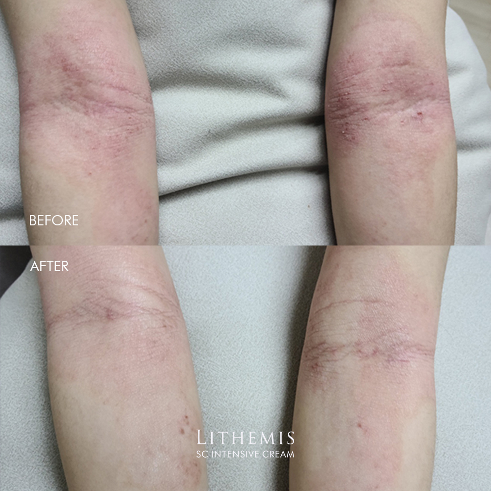 리더미스 인텐시브 크림 150ml