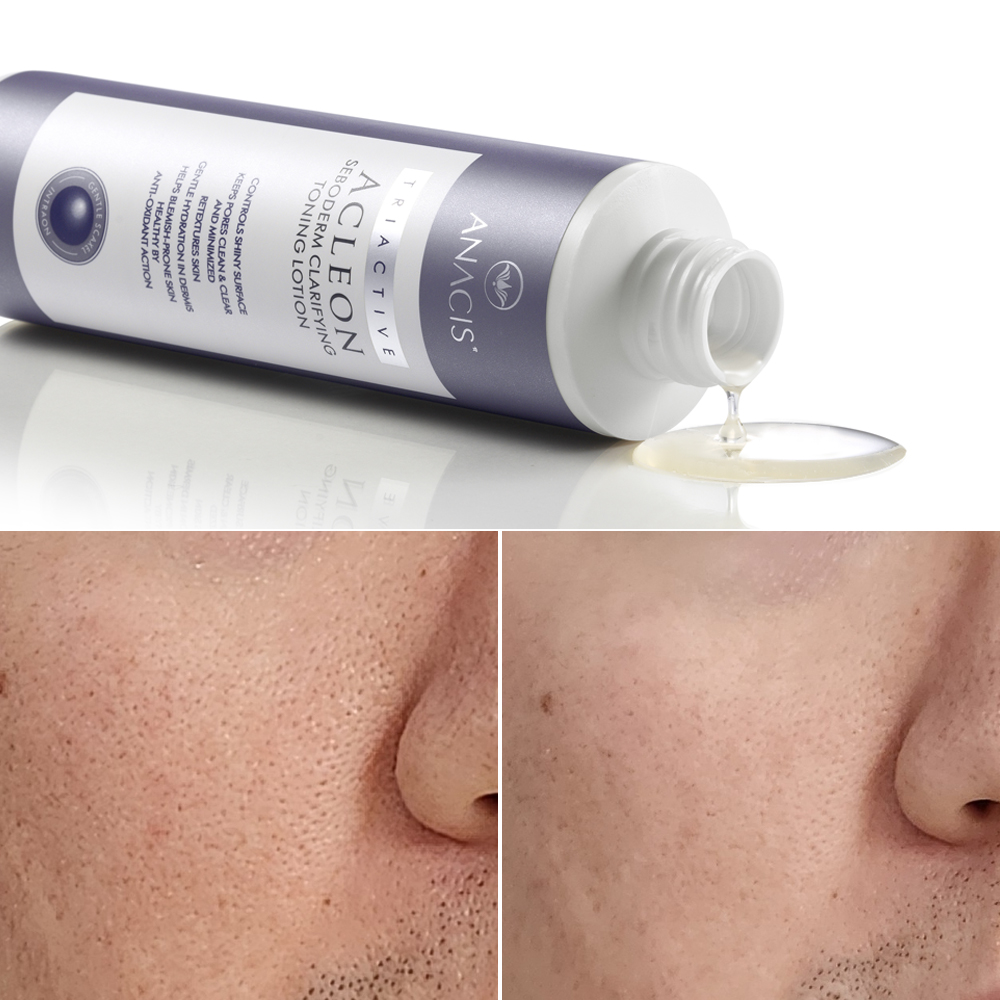 아클레온 클렌징젤 200ml + 토닝로션 200ml