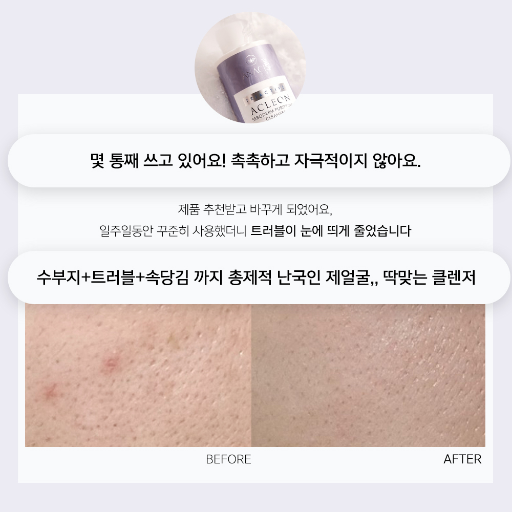 아클레온 클렌징젤 200ml + 토닝로션 200ml