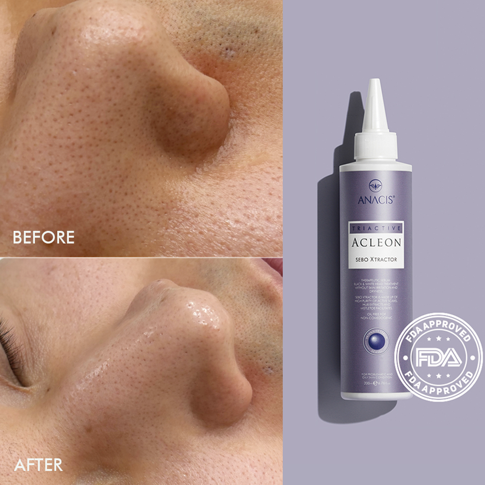 아클레온 세보엑스 200ml + 클렌징젤 200ml