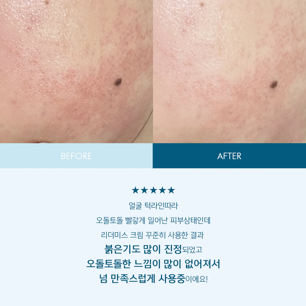 리더미스 인텐시브 크림 150ml + 리더미스 리싱크 세럼 55ml