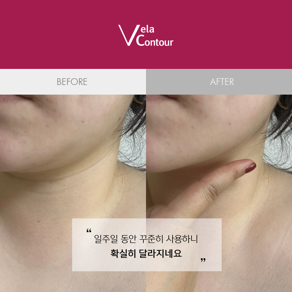 벨라컨투어 울트라 리프팅 밴드 + 리필팩 1세트 + 컨투어링 세럼30ml