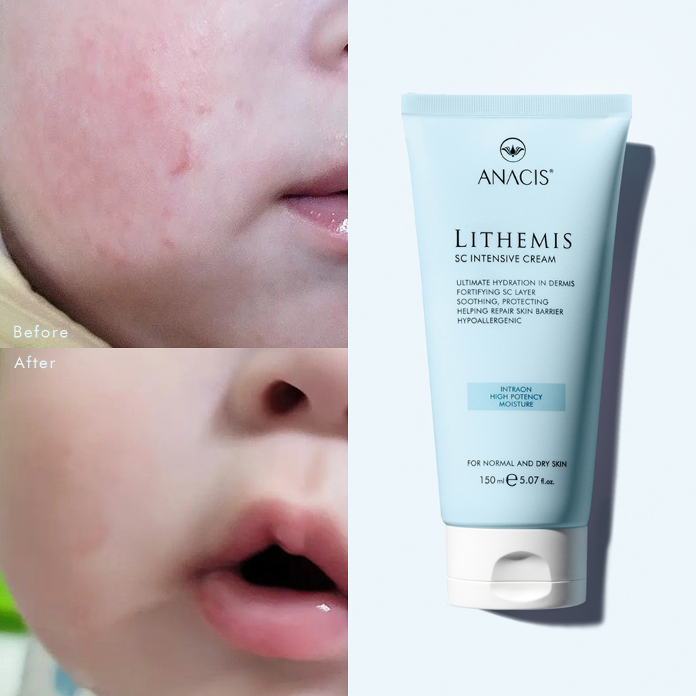 리더미스 인텐시브크림 50g