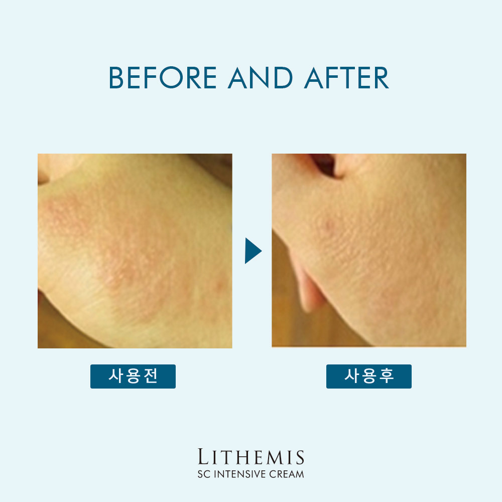 리더미스 인텐시브크림 50g