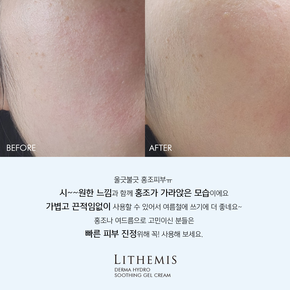 아나시스 지성피부 수부지 여행용 기초 화장품 2종 5ml 4개
