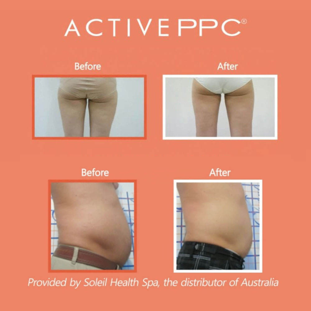 액티브 PPC크림 500g 2개+바디괄사 1개